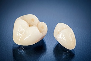 A closeup of ceramic dental crowns